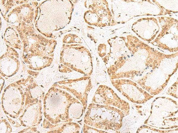 RBM19 Polyclonal Antibody Reactivity Human