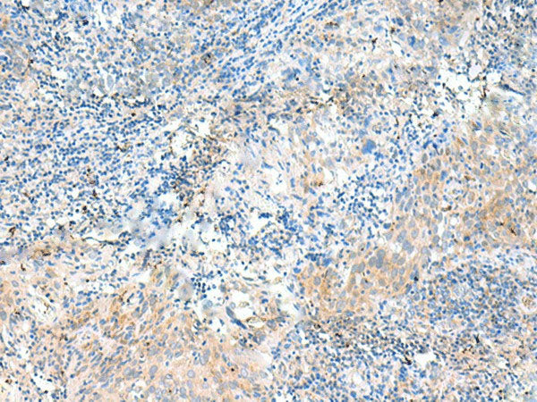 NID2 Polyclonal Antibody Reactivity Human