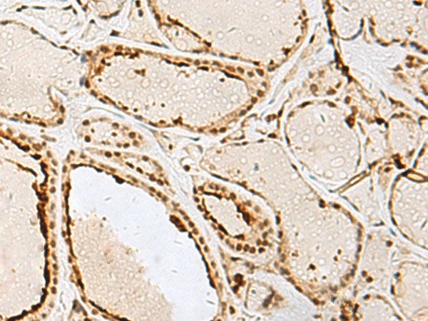 IPO11 Polyclonal Antibody Reactivity Human