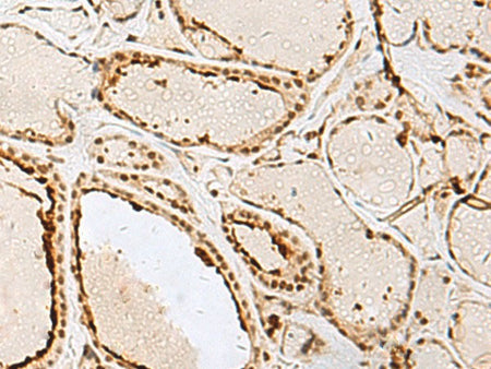 IPO11 Polyclonal Antibody Reactivity Human