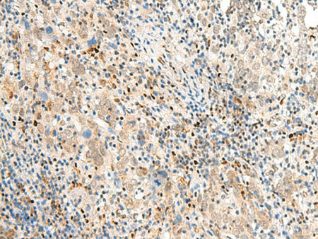 POM121 Polyclonal Antibody Reactivity Human