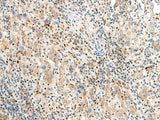 POM121 Polyclonal Antibody Reactivity Human