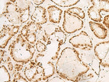 POM121 Polyclonal Antibody Reactivity Human
