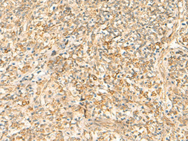 EMC1 Polyclonal Antibody Reactivity Human