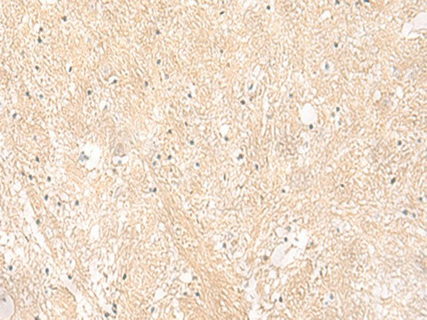 EMC1 Polyclonal Antibody Reactivity Human