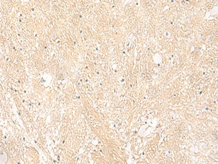EMC1 Polyclonal Antibody Reactivity Human