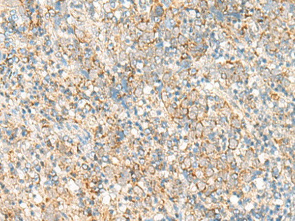 PSD4 Polyclonal Antibody Reactivity Human
