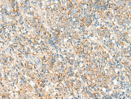 PSD4 Polyclonal Antibody Reactivity Human