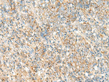 PSD4 Polyclonal Antibody Reactivity Human