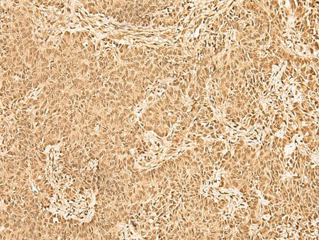 ZNF471 Polyclonal Antibody Reactivity Human