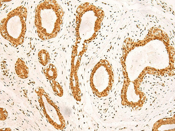 ZNF471 Polyclonal Antibody Reactivity Human