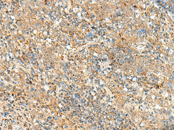 FKBP1A Polyclonal Antibody Reactivity Human