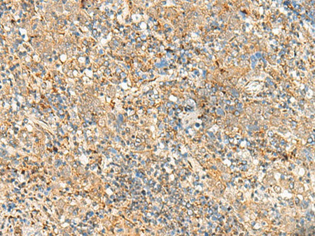 FKBP1A Polyclonal Antibody Reactivity Human