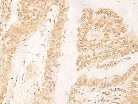 RBX1 Polyclonal Antibody Reactivity Human