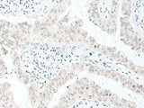 ENSA Polyclonal Antibody Reactivity Human