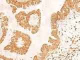 POLR1D Polyclonal Antibody
