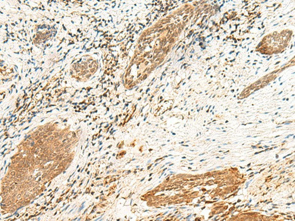 POLR1D Polyclonal Antibody