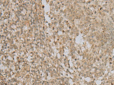 LYRM1 Polyclonal Antibody Reactivity Human