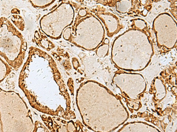 LYRM1 Polyclonal Antibody Reactivity Human