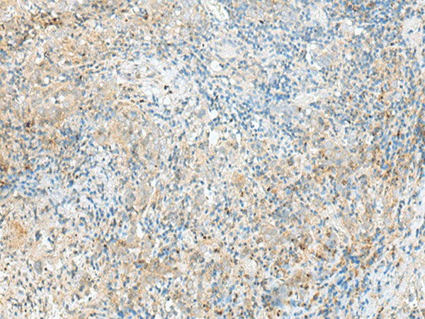 RPP14 Polyclonal Antibody