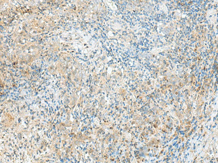 RPP14 Polyclonal Antibody