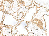 RPP14 Polyclonal Antibody