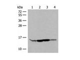RPP14 Polyclonal Antibody
