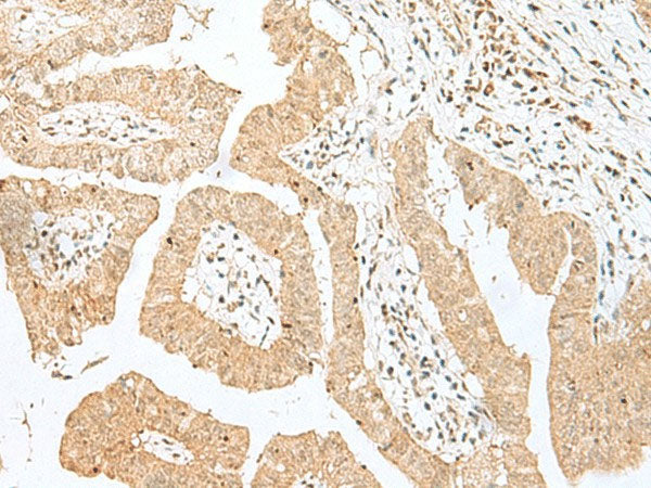 BEX2 Polyclonal Antibody Reactivity Human