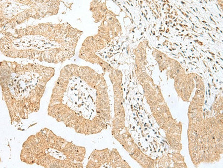 BEX2 Polyclonal Antibody Reactivity Human