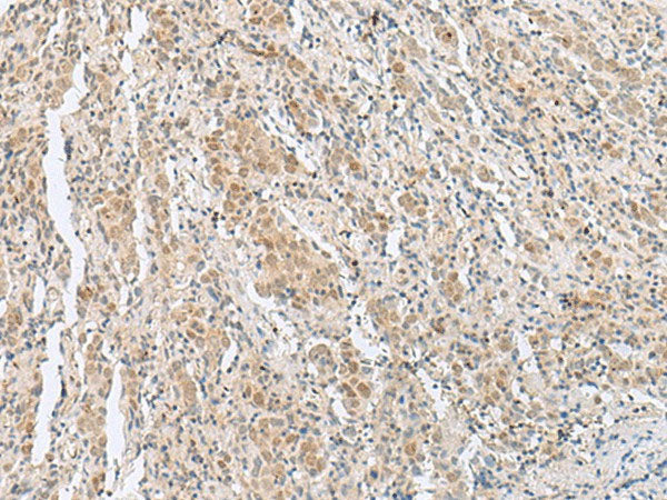 HIST1H2BK Polyclonal Antibody Reactivity Human