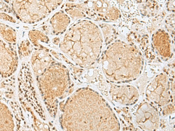 HIST1H2BK Polyclonal Antibody Reactivity Human