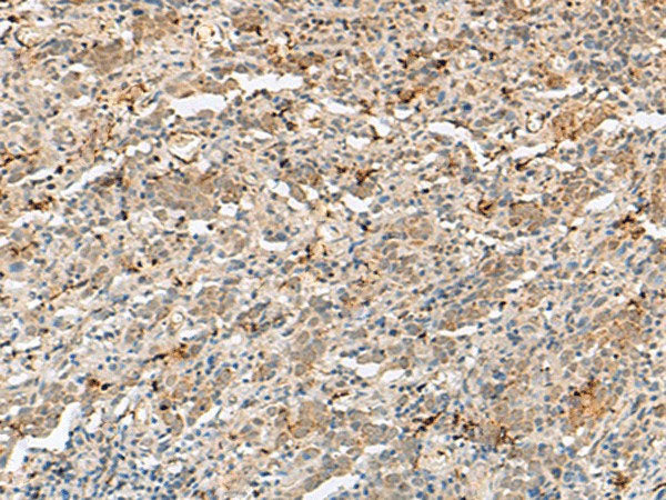 H3F3B Polyclonal Antibody Reactivity Human