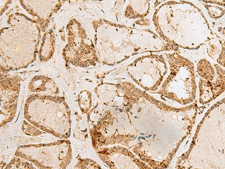 H3F3B Polyclonal Antibody Reactivity Human