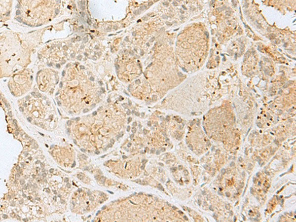 GOLGA7 Polyclonal Antibody Reactivity Human
