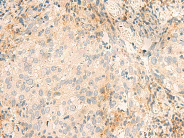 GSKIP Polyclonal Antibody Reactivity Human