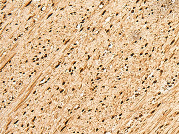 PNRC2 Polyclonal Antibody Reactivity Human