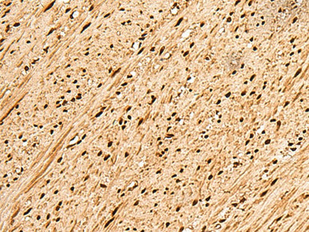 PNRC2 Polyclonal Antibody Reactivity Human