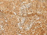 PNRC2 Polyclonal Antibody Reactivity Human