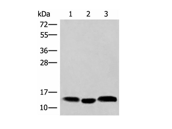 HBE1 Polyclonal Antibody Reactivity Human