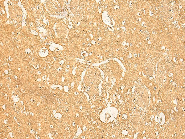 RNASE4 Polyclonal Antibody