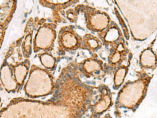 NPC2 Polyclonal Antibody Reactivity Human