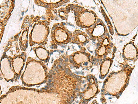 NPC2 Polyclonal Antibody Reactivity Human