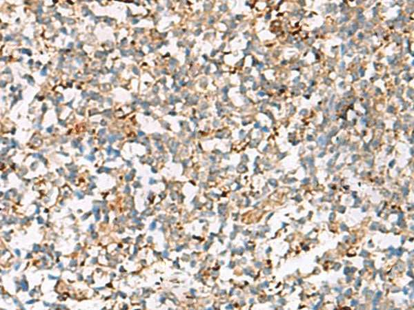 NPC2 Polyclonal Antibody Reactivity Human