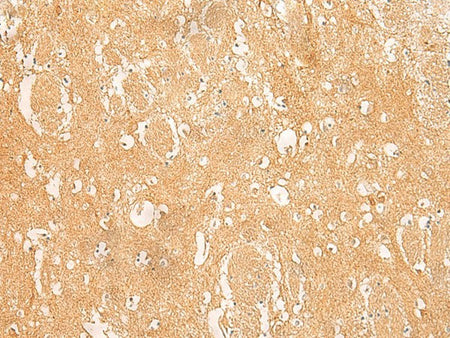 ARPC5L Polyclonal Antibody Reactivity Human