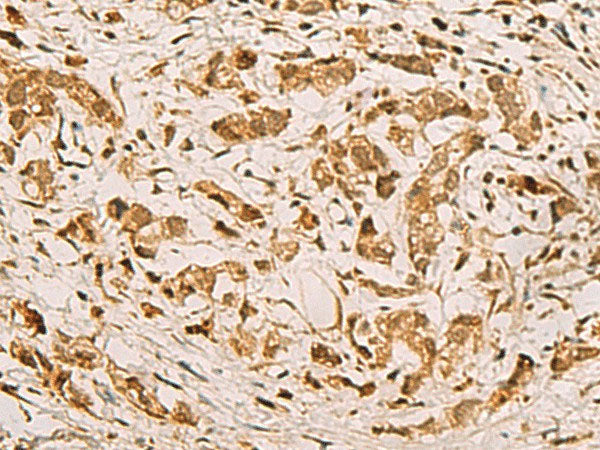 ZMAT4 Polyclonal Antibody