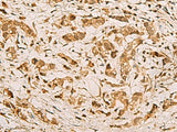 ZMAT4 Polyclonal Antibody