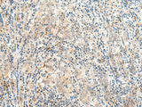 JPT1 Polyclonal Antibody Reactivity Human
