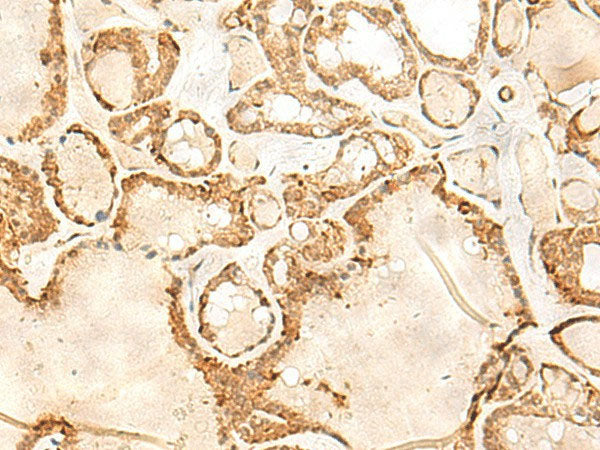 JPT1 Polyclonal Antibody Reactivity Human