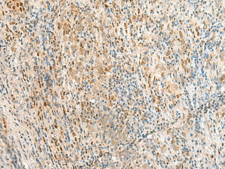 RPS27A Polyclonal Antibody Reactivity Human