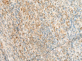 RPS27A Polyclonal Antibody Reactivity Human